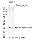 Phospho-EIF2A (Ser51) Antibody in Western Blot (WB)