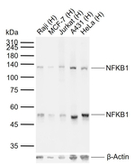 NFkB p50/p105 Recombinant Rabbit Monoclonal Antibody (12G3)