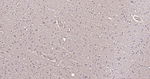 Tau Antibody in Immunohistochemistry (Paraffin) (IHC (P))