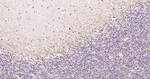 Tau Antibody in Immunohistochemistry (Paraffin) (IHC (P))