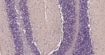 Tau Antibody in Immunohistochemistry (Paraffin) (IHC (P))