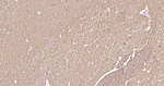 Tau Antibody in Immunohistochemistry (Paraffin) (IHC (P))