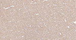Tau Antibody in Immunohistochemistry (Paraffin) (IHC (P))