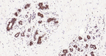 Tau Antibody in Immunohistochemistry (Paraffin) (IHC (P))