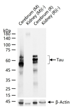 Tau Antibody in Western Blot (WB)