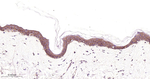 EGFR Antibody in Immunohistochemistry (Paraffin) (IHC (P))