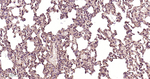 EGFR Antibody in Immunohistochemistry (Paraffin) (IHC (P))