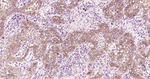 EGFR Antibody in Immunohistochemistry (Paraffin) (IHC (P))