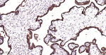 EGFR Antibody in Immunohistochemistry (Paraffin) (IHC (P))