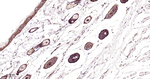 EGFR Antibody in Immunohistochemistry (Paraffin) (IHC (P))