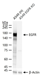 EGFR Antibody in Western Blot (WB)