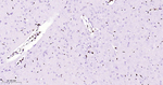 ERG Antibody in Immunohistochemistry (Paraffin) (IHC (P))