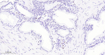 ERG Antibody in Immunohistochemistry (Paraffin) (IHC (P))