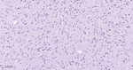 ERG Antibody in Immunohistochemistry (Paraffin) (IHC (P))