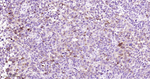 Melan-A Recombinant Rabbit Monoclonal Antibody (6E11)
