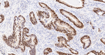 CDX2 Antibody in Immunohistochemistry (Paraffin) (IHC (P))