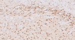 HSP90 alpha Antibody in Immunohistochemistry (Paraffin) (IHC (P))