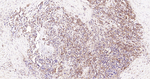 HSP90 alpha Antibody in Immunohistochemistry (Paraffin) (IHC (P))