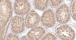 HSP90 alpha Antibody in Immunohistochemistry (Paraffin) (IHC (P))