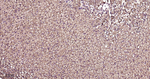 LDLR Recombinant Rabbit Monoclonal Antibody (1A7)