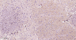 LDLR Antibody in Immunohistochemistry (Paraffin) (IHC (P))