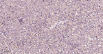 LDLR Antibody in Immunohistochemistry (Paraffin) (IHC (P))