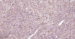 LDLR Antibody in Immunohistochemistry (Paraffin) (IHC (P))