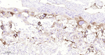 CD61 Antibody in Immunohistochemistry (Paraffin) (IHC (P))