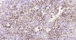 CD61 Antibody in Immunohistochemistry (Paraffin) (IHC (P))