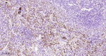 CD61 Antibody in Immunohistochemistry (Paraffin) (IHC (P))