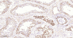 CD61 Antibody in Immunohistochemistry (Paraffin) (IHC (P))