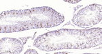 CD61 Antibody in Immunohistochemistry (Paraffin) (IHC (P))