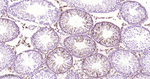 CD61 Antibody in Immunohistochemistry (Paraffin) (IHC (P))