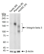 CD61 Antibody in Western Blot (WB)