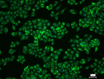 CD63 Recombinant Rabbit Monoclonal Antibody (4C2)