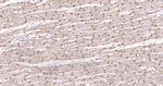 N-cadherin Antibody in Immunohistochemistry (Paraffin) (IHC (P))