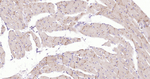 N-cadherin Antibody in Immunohistochemistry (Paraffin) (IHC (P))
