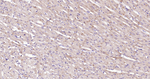 N-cadherin Antibody in Immunohistochemistry (Paraffin) (IHC (P))