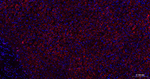 N-cadherin Antibody in Immunohistochemistry (Paraffin) (IHC (P))