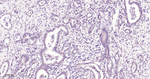 NOX4 Antibody in Immunohistochemistry (Paraffin) (IHC (P))