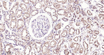 NOX4 Antibody in Immunohistochemistry (Paraffin) (IHC (P))