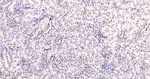 NOX4 Antibody in Immunohistochemistry (Paraffin) (IHC (P))