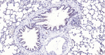 NOX4 Antibody in Immunohistochemistry (Paraffin) (IHC (P))