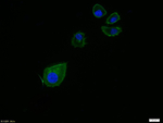 Alpha-Smooth Muscle Actin Recombinant Rabbit Monoclonal Antibody (8C3)