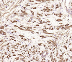 Alpha-Smooth Muscle Actin Antibody in Immunohistochemistry (Paraffin) (IHC (P))