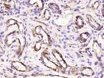 Alpha-Smooth Muscle Actin Antibody in Immunohistochemistry (Paraffin) (IHC (P))