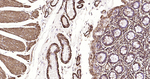 Alpha-Smooth Muscle Actin Antibody in Immunohistochemistry (Paraffin) (IHC (P))