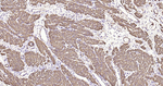 Alpha-Smooth Muscle Actin Antibody in Immunohistochemistry (Paraffin) (IHC (P))