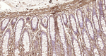 Alpha-Smooth Muscle Actin Antibody in Immunohistochemistry (Paraffin) (IHC (P))