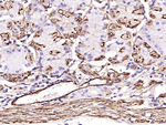 Alpha-Smooth Muscle Actin Antibody in Immunohistochemistry (Paraffin) (IHC (P))